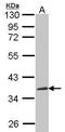 Cellular Communication Network Factor 3 antibody, PA5-27893, Invitrogen Antibodies, Western Blot image 