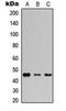 Gap Junction Protein Alpha 3 antibody, LS-C356058, Lifespan Biosciences, Western Blot image 