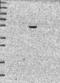 Carbohydrate Sulfotransferase 5 antibody, NBP1-91785, Novus Biologicals, Western Blot image 