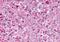 Endothelin Receptor Type B antibody, MBS243624, MyBioSource, Immunohistochemistry frozen image 