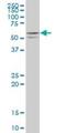 Serine/Threonine Kinase 25 antibody, H00010494-M02, Novus Biologicals, Western Blot image 