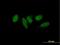 Mediator Complex Subunit 9 antibody, H00055090-B01P, Novus Biologicals, Immunocytochemistry image 