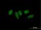 Mediator of RNA polymerase II transcription subunit 9 antibody, H00055090-B01P, Novus Biologicals, Immunocytochemistry image 