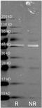 Catalase antibody, orb344572, Biorbyt, Western Blot image 