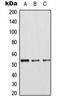 Cyclin Dependent Kinase 8 antibody, LS-C353939, Lifespan Biosciences, Western Blot image 