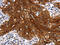 JNK1 + JNK2 antibody, CSB-PA208890, Cusabio, Immunohistochemistry paraffin image 