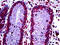 CDKN2A antibody, 51-657, ProSci, Enzyme Linked Immunosorbent Assay image 