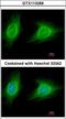 Rho Associated Coiled-Coil Containing Protein Kinase 1 antibody, LS-C186291, Lifespan Biosciences, Immunocytochemistry image 