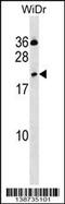 C-Type Lectin Domain Family 2 Member D antibody, 60-217, ProSci, Western Blot image 