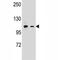 CD11b antibody, F40833-0.4ML, NSJ Bioreagents, Immunohistochemistry paraffin image 