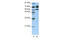 Adenosine Deaminase RNA Specific B1 antibody, ARP40342_T100, Aviva Systems Biology, Western Blot image 