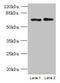 TBC1 Domain Family Member 19 antibody, CSB-PA843274LA01HU, Cusabio, Western Blot image 
