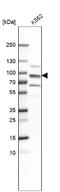 Leucine Zipper Like Transcription Regulator 1 antibody, NBP2-49649, Novus Biologicals, Western Blot image 