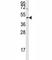 Aurora Kinase B antibody, F50224-0.4ML, NSJ Bioreagents, Western Blot image 