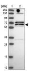 Deltex E3 Ubiquitin Ligase 2 antibody, PA5-60164, Invitrogen Antibodies, Western Blot image 