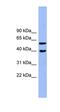 Allantoicase antibody, orb326171, Biorbyt, Western Blot image 