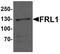 Formin Like 1 antibody, PA5-34477, Invitrogen Antibodies, Western Blot image 