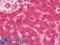 G Protein-Coupled Receptor Kinase 2 antibody, LS-C317251, Lifespan Biosciences, Immunohistochemistry paraffin image 