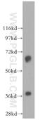 Mitochondrial Trans-2-Enoyl-CoA Reductase antibody, 51027-2-AP, Proteintech Group, Western Blot image 