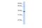 Hydroxyacid Oxidase 2 antibody, GTX47157, GeneTex, Western Blot image 