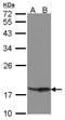 Phospholipase A And Acyltransferase 4 antibody, NBP1-31057, Novus Biologicals, Western Blot image 