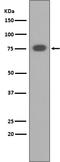 Protein Kinase C Alpha antibody, M00743, Boster Biological Technology, Western Blot image 