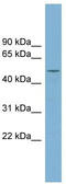 Arginyl Aminopeptidase Like 1 antibody, TA344900, Origene, Western Blot image 