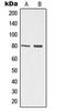 Tumor Protein P73 antibody, LS-C352963, Lifespan Biosciences, Western Blot image 