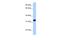 Acrosomal Vesicle Protein 1 antibody, A11311, Boster Biological Technology, Western Blot image 