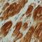 Actin Alpha 2, Smooth Muscle antibody, MAB1420, R&D Systems, Immunohistochemistry paraffin image 