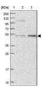 DEAD-Box Helicase 49 antibody, NBP2-48749, Novus Biologicals, Western Blot image 