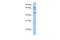 Testis Specific Serine Kinase Substrate antibody, PA5-44118, Invitrogen Antibodies, Western Blot image 