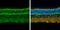 Solute Carrier Family 1 Member 3 antibody, GTX134060, GeneTex, Immunohistochemistry paraffin image 