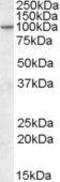 ArfGAP With GTPase Domain, Ankyrin Repeat And PH Domain 2 antibody, GTX88422, GeneTex, Western Blot image 