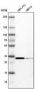 Cyclin Dependent Kinase 1 antibody, NBP1-85729, Novus Biologicals, Western Blot image 