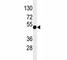 Paired Box 6 antibody, F53525-0.1ML, NSJ Bioreagents, Western Blot image 