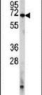 Phosphodiesterase 8A antibody, PA5-11533, Invitrogen Antibodies, Western Blot image 