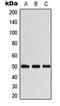 Arrestin Beta 1 antibody, orb216022, Biorbyt, Western Blot image 