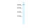 Chloride Voltage-Gated Channel 3 antibody, 28-302, ProSci, Western Blot image 