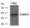 Calcium/Calmodulin Dependent Protein Kinase II Alpha antibody, GTX50706, GeneTex, Western Blot image 