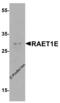 Serine And Arginine Rich Splicing Factor 3 antibody, 8193, ProSci, Western Blot image 