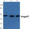 Angiopoietin Like 7 antibody, PA5-36575, Invitrogen Antibodies, Western Blot image 