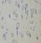 Smoothened, Frizzled Class Receptor antibody, FNab08037, FineTest, Immunohistochemistry paraffin image 