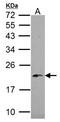 NADH:Ubiquinone Oxidoreductase Subunit B5 antibody, LS-C186234, Lifespan Biosciences, Western Blot image 