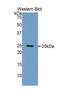 Fibulin 2 antibody, LS-C300873, Lifespan Biosciences, Western Blot image 