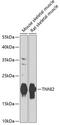 Troponin I2, Fast Skeletal Type antibody, GTX32927, GeneTex, Western Blot image 