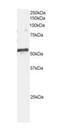 ADP Ribosylation Factor GTPase Activating Protein 3 antibody, orb18324, Biorbyt, Western Blot image 