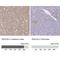 Transgelin 3 antibody, NBP2-37995, Novus Biologicals, Immunohistochemistry paraffin image 