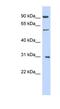 Mannosyl (Alpha-1,6-)-Glycoprotein Beta-1,2-N-Acetylglucosaminyltransferase antibody, NBP1-62441, Novus Biologicals, Western Blot image 