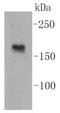 Nitric Oxide Synthase 1 antibody, NBP2-67532, Novus Biologicals, Western Blot image 